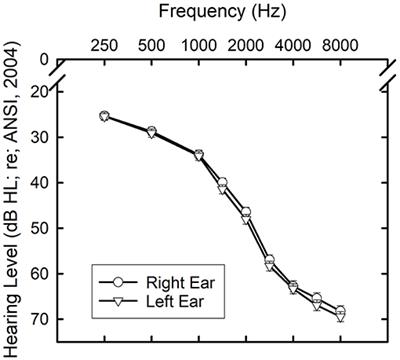 Development of the SWB-HL: A Scale of the Subjective Well-Being of Older Adults With Hearing Loss